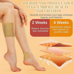 Kartsyy Turmeric Varicose Vein Patches – Pack of 10
